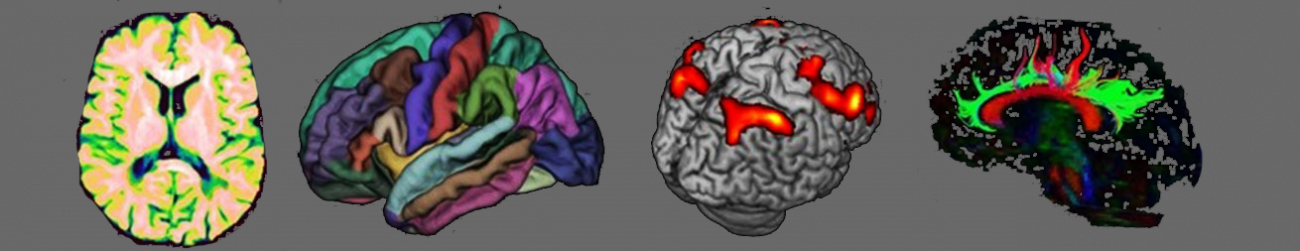 The Italian Neuroimaging Network Initiative (INNI)